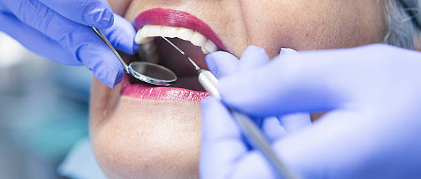 Best Emergency Dentist for Lost Fillings or Crowns in Cashion, OK
